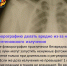 5 МИФОВ О ФЛЮОРОГРАФИИ - Противотуберкулезный диспансер
