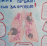 Курение вредит вашему здоровью! - Противотуберкулезный диспансер