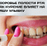 Здоровье полости рта: как курение влияет на вашу улыбку - РЦМП